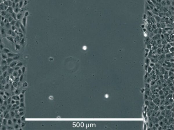 Image_Product_INS_Ibidi_CultureInsert2well24_1000x749_JPG_02 Image_Product_INS_Ibidi_CultureInsert2well24_1000x749_JPG_02