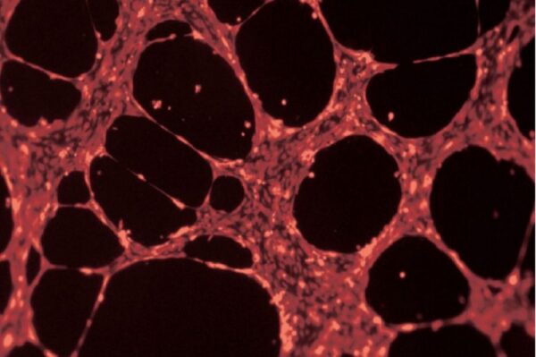 Image_Product_INS_Ibidi_PlateAngiogenesis96well_1000x665_JPG_02 Image_Product_INS_Ibidi_PlateAngiogenesis96well_1000x665_JPG_02