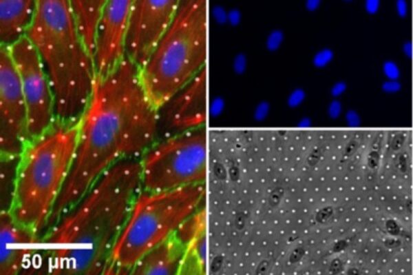 Image_TEC_INS_Ibidi_SlideMembrane_02_1000x665_JPG Image_TEC_INS_Ibidi_SlideMembrane_02_1000x665_JPG